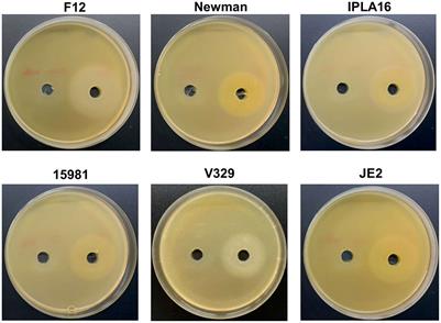 Synergistic removal of Staphylococcus aureus biofilms by using a combination of phage Kayvirus rodi with the exopolysaccharide depolymerase Dpo7